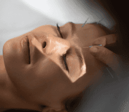 Facial acupuncture